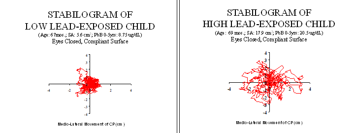 A chart showing predicted sway area increasing as the mean blood lead increases in a patient.