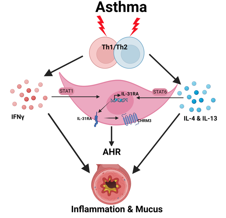 Asthma Research Program Image depiction of Asthma