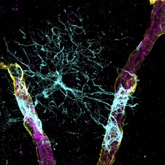 photo of astrocyte