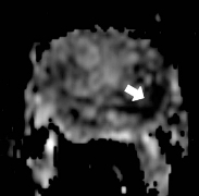 verma-fig-2b-resized verma-fig-2b-resized